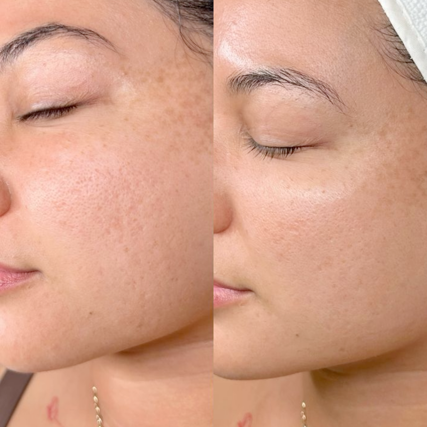 Matcha 10 Minute Mask™